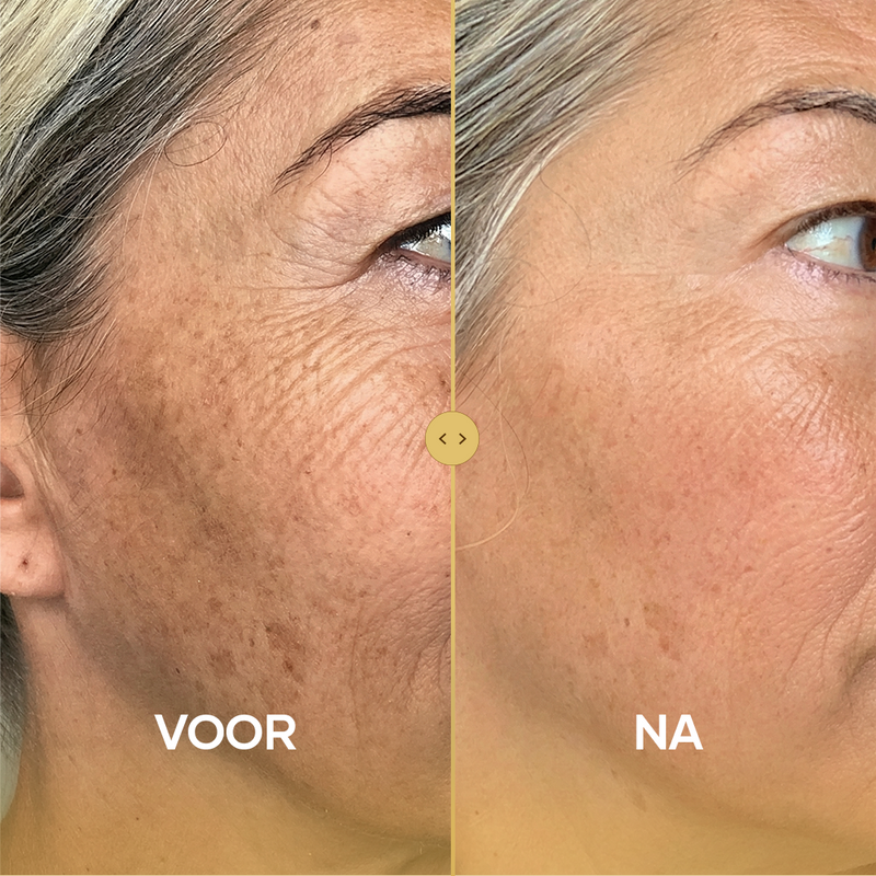 MORE NATURAL COLLAGEN PRODUCTION