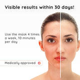 AmaraPure™ Rood licht masker + nek AP147 Zwart - AmaraPure
