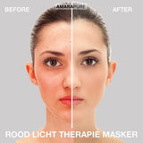 AmaraPure™ Rood licht masker AP714 - AmaraPure